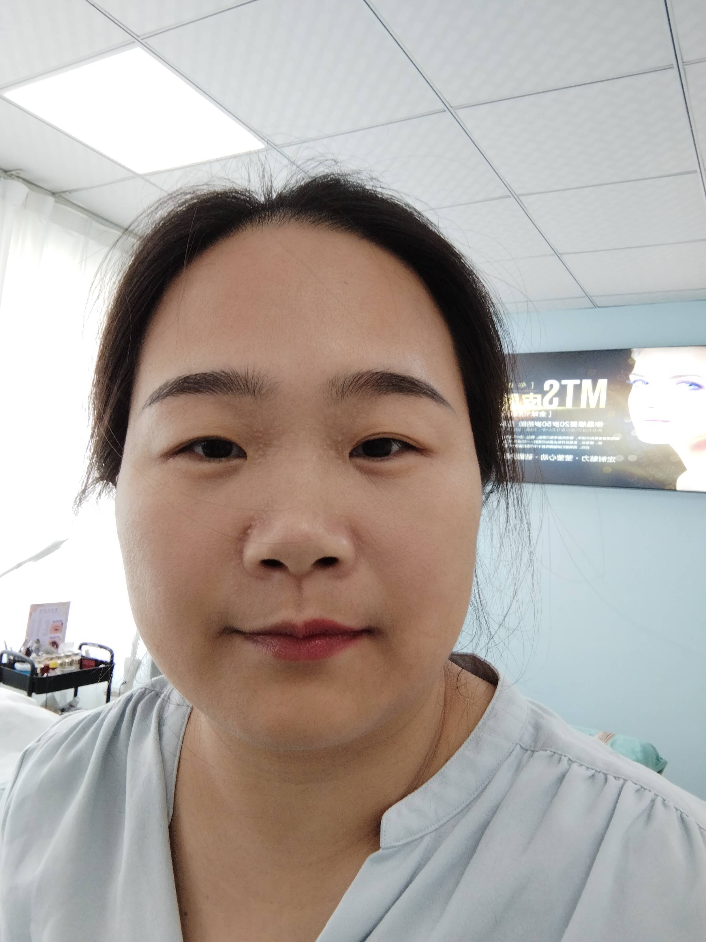 小汪