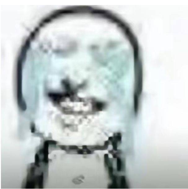 瓜