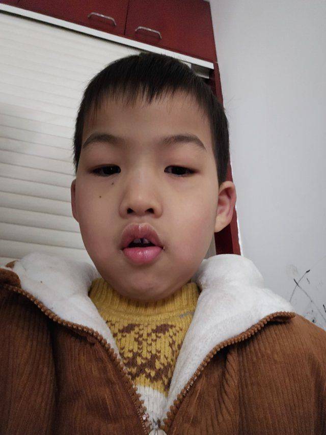 房东直租