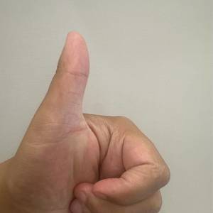 可怜的小毛孩